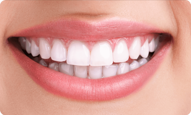 After (Teeth)